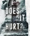 does it hurt
